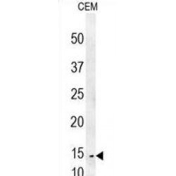 Cysteine-Rich C-Terminal Protein 1 (CRCT1) Antibody