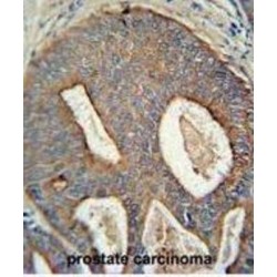 POTE Ankyrin Domain Family Member B (POTEB) Antibody