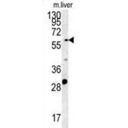 POTE Ankyrin Domain Family Member B (POTEB) Antibody