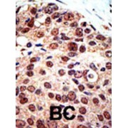 Protein Arginine Methyltransferase 3 (PRMT3) Antibody