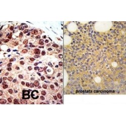 Protein Arginine Methyltransferase 3 (PRMT3) Antibody