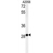 C11orf46 Antibody