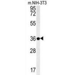 Galectin-9B (LGALS9B) Antibody
