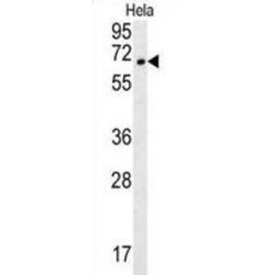 Transmembrane Protein 214 (TMEM214) Antibody