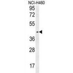 Lysosomal-Associated Transmembrane Protein 5 (LAPTM5) Antibody