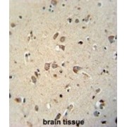Magnesium Transporter NIPA4 (NIPA4) Antibody