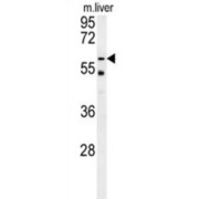 Peroxisomal Leader Peptide-Processing Protease (TYSND1) Antibody