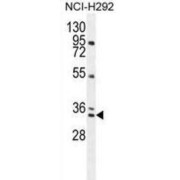 A-Kinase-Interacting Protein 1 (BCA3) Antibody