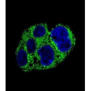 Alpha-Methylacyl-CoA Racemase (AMACR) Antibody