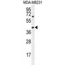 Alpha-Methylacyl-CoA Racemase (AMACR) Antibody