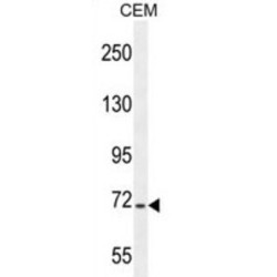 Stromal Interaction Molecule 1 (STIM1) Antibody