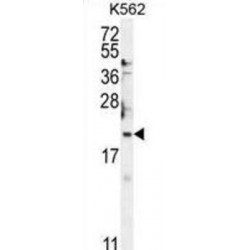 B-Cell Translocation Gene 2 (BTG2) Antibody