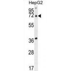 Acyl-CoA Thioesterase 11 (ACOT11) Antibody