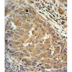 Fibroblast Growth Factor 2 (FGF2) Antibody