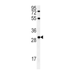 Fibroblast Growth Factor 2 (FGF2) Antibody