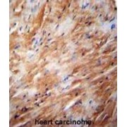 Dimethyladenosine Transferase 2, Mitochondrial (TFB2M) Antibody