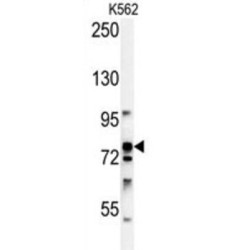 Ribosomal Protein S6 Kinase Alpha 1 (RPS6KA1) Antibody