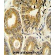 ADP-Ribosylation Factor-Like Protein 8A (ARL8A) Antibody