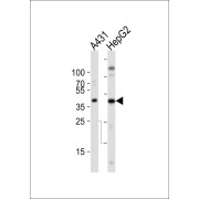 Western blot analysis of A431 (Lane 1) and HepG2 (Lane 2) cells (20 µg per lane) using Actin, Cytoplasmic 1 (ACTB) Antibody (1/1000 dilution) and HRP-conjugated Goat Anti-Rabbit IgG H+L (1/10000 dilution).