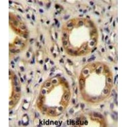 Chemokine C-X-C-Motif Receptor 3 (CXCR3) Antibody