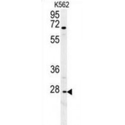 Chemokine C-X-C-Motif Receptor 3 (CXCR3) Antibody