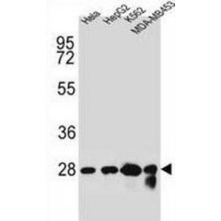 Choline Phosphotransferase 1 (CHPT1) Antibody