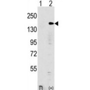 Euchromatic Histone-Lysine N-Methyltransferase 1 (EHMT1) Antibody