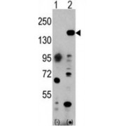 Euchromatic Histone-Lysine N-Methyltransferase 1 (EHMT1) Antibody