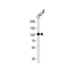 Neprilysin / NEP (MME) Antibody