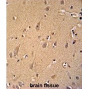 GRIP And Coiled-Coil Domain-Containing Protein 2 (GCC2) Antibody