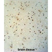 abx025634