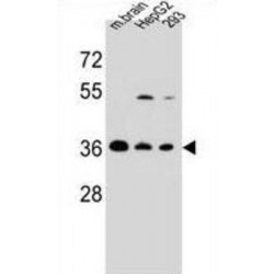 F-Box Protein 2 (FBXO2) Antibody