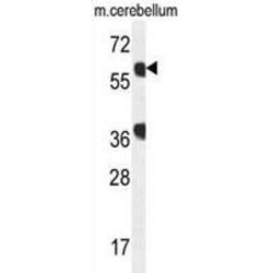 GTP Binding Protein 2 (GTPBP2) Antibody