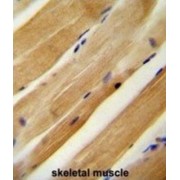 MLX Interacting Protein (MLXIP) Antibody
