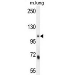 MLX Interacting Protein (MLXIP) Antibody
