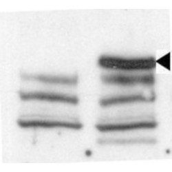 Lysine Specific Demethylase 6B (KDM6B) Antibody