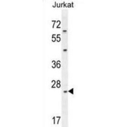 Claudin-22 (CLDN22) Antibody