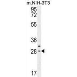 Claudin-22 (CLDN22) Antibody