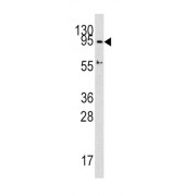 DNA (cytosine-5)-Methyltransferase 3A (DNMT3A) Antibody