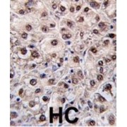 Phosphatidylethanolamine N-Methyltransferase (PEMT) Antibody