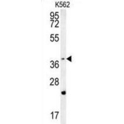 F-Box And WD Repeat Domain Containing 12 (FBXW12) Antibody