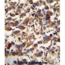 Transcription Factor A, Mitochondrial (TFAM) Antibody