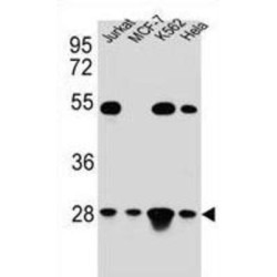 Transcription Factor A, Mitochondrial (TFAM) Antibody