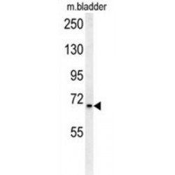 Calcium-Binding Mitochondrial Carrier Protein Aralar1 (SLC25A12) Antibody