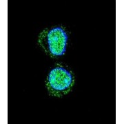 Homeobox Protein Hox-A10 (HOXA10) Antibody