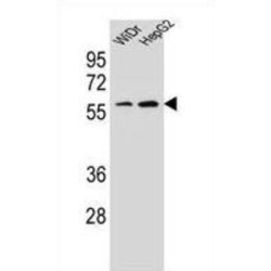 Homeobox Protein Hox-A10 (HOXA10) Antibody