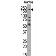 Lysine-Specific Demethylase 3B (JMJD1B) Antibody