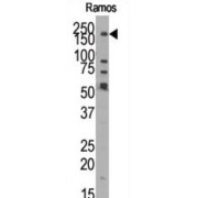 Lysine-Specific Demethylase 3B (JMJD1B) Antibody