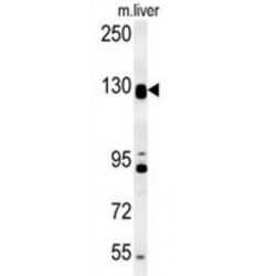DENN Domain-Containing Protein 5B (DENND5B) Antibody