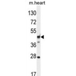 Rab Interacting Lysosomal Protein Like 1 (RILPL1) Antibody